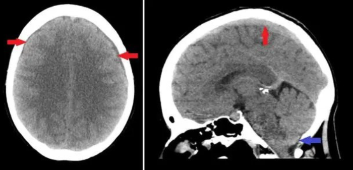 Sổ mũi suốt 4 năm, người phụ nữ đi khám thì phát hiện bệnh nguy hiểm tính mạng Ảnh 3