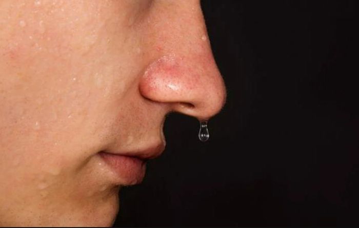 Sổ mũi suốt 4 năm, người phụ nữ đi khám thì phát hiện bệnh nguy hiểm tính mạng Ảnh 2