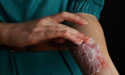 Những mẹo dân gian truyền miệng đang hại bạn mỗi ngày: Đừng làm theo kẻo hối hận Ảnh 3