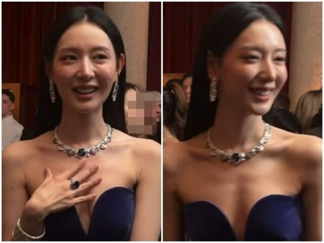 Cận cảnh gương mặt có phần hốc hác gây lo lắng của nữ diễn viên 'Nữ hoàng nước mắt'. - Ảnh: My Daily