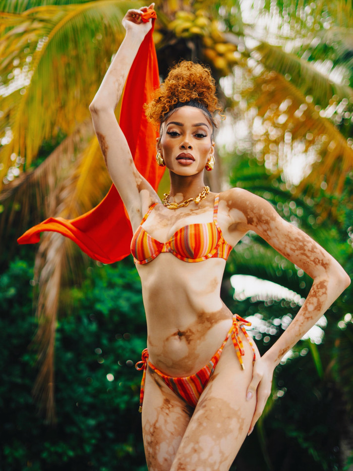 Winnie Harlow tạo dáng đầy chuyên nghiệp. Ảnh: IGNV