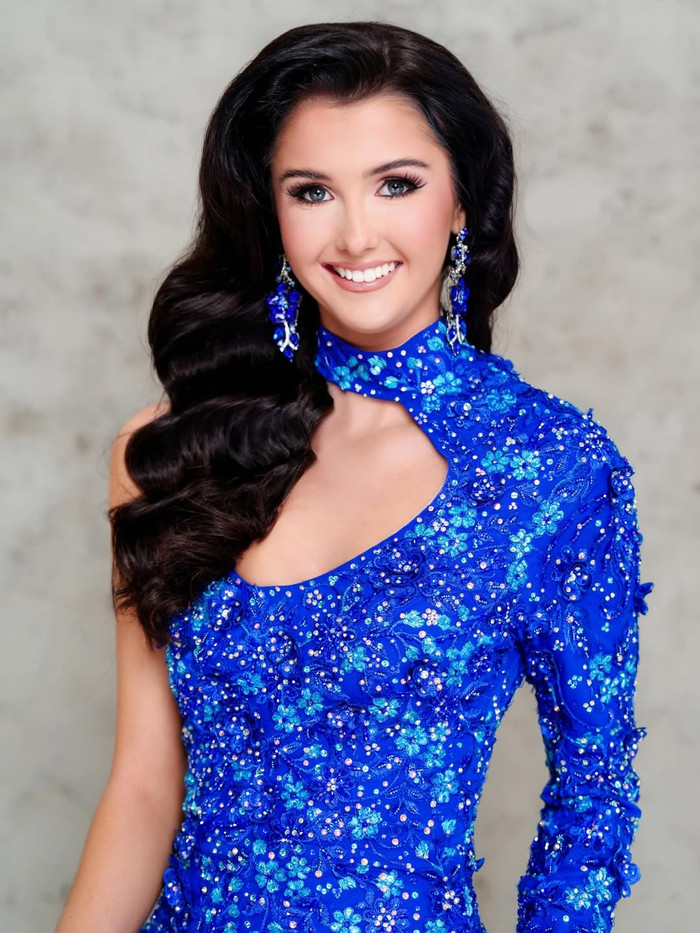 Charlie gây ấn tượng với gương mặt hài hòa, sắc nét. Ảnh: IGNV