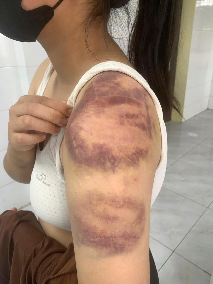 Đánh con gái và vợ đang mang thai, bố bị con tố cáo lên Công an Ảnh 2