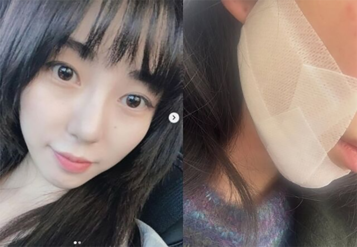 Kwon Mina thông báo đi làm trở lại sau thời gian điều trị chấn thương.