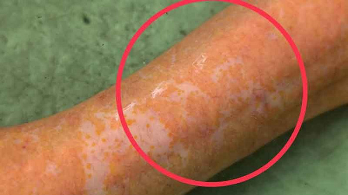 Người phụ nữ bắt được con lươn màu vàng cực hiếm, dân làng đổ xô đến xem Ảnh 3