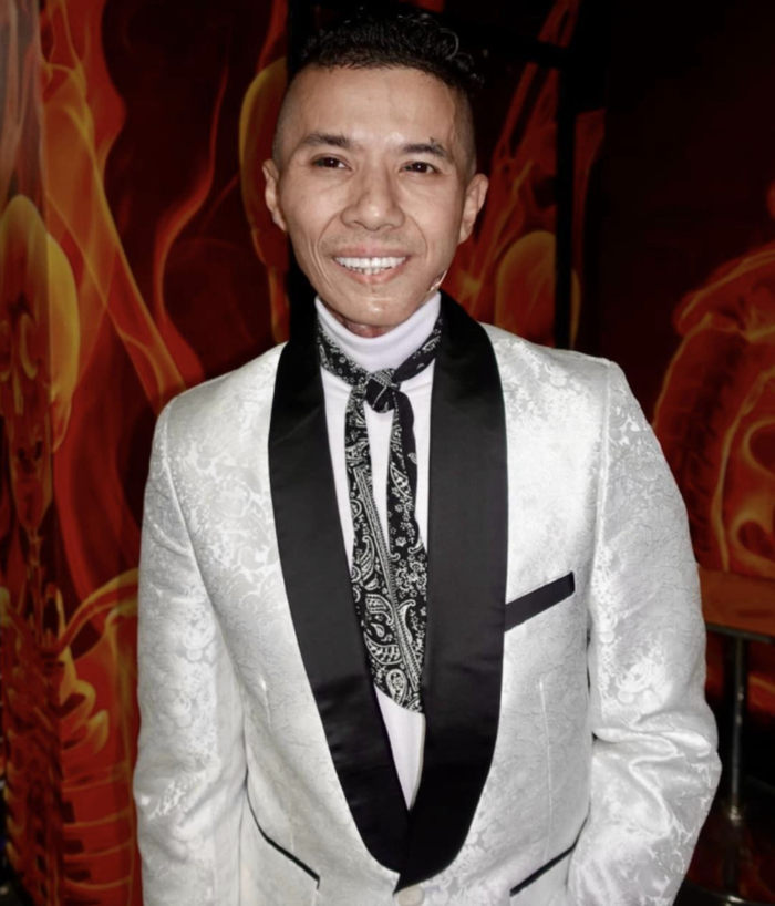 Kasim Hoàng Vũ đã chống chọi với căn bệnh viêm xương khớp hàm trong một thời gian dài&nbsp;