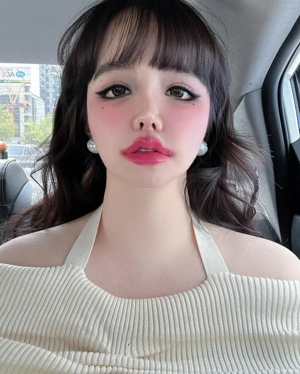 Người hâm mộ đặc biệt lo lắng cho tình trạng sức khoẻ của Park Bom.