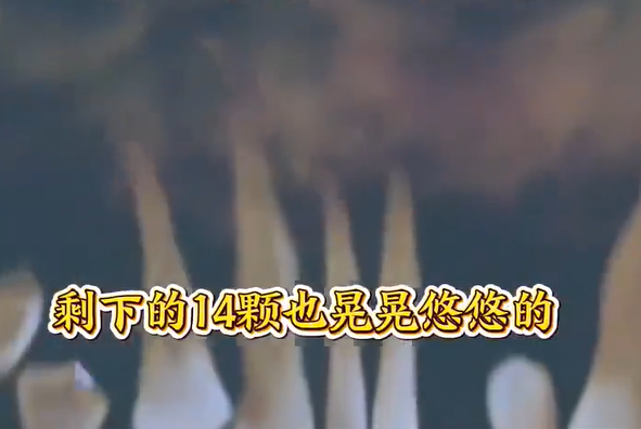 Người đàn ông 44 tuổi nhổ 14 chiếc răng, nguyên nhân khiến ai cũng xôn xao Ảnh 3