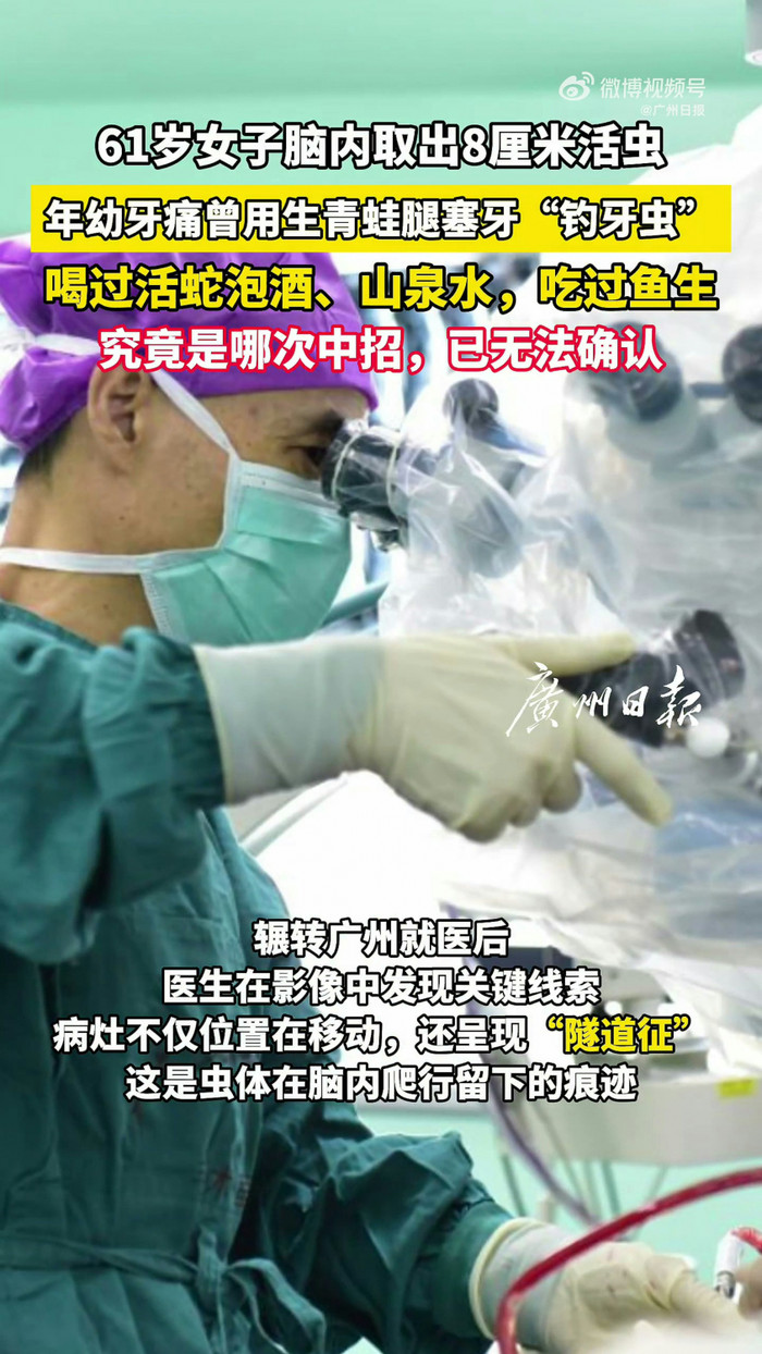 Người phụ nữ nhập viện vì bị ớn lạnh, bác sĩ kinh hoàng khi lấy ra thứ trong đầu Ảnh 1