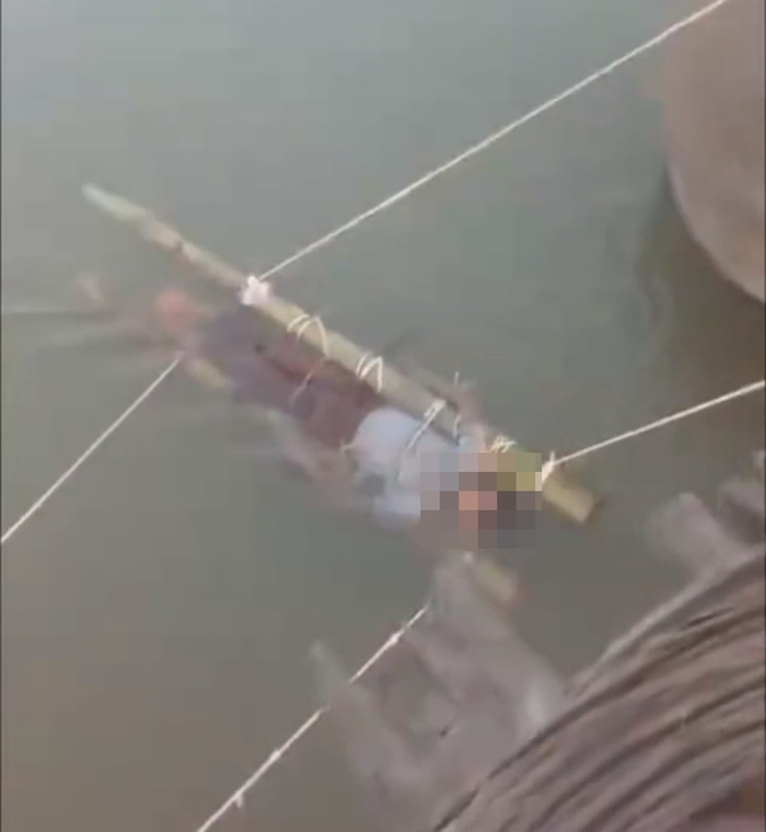 Cậu bé 13 tuổi bị rắn độc cắn, gia đình nghe lời 'thần y' chữa trị dẫn đến kết cục đau lòng Ảnh 2