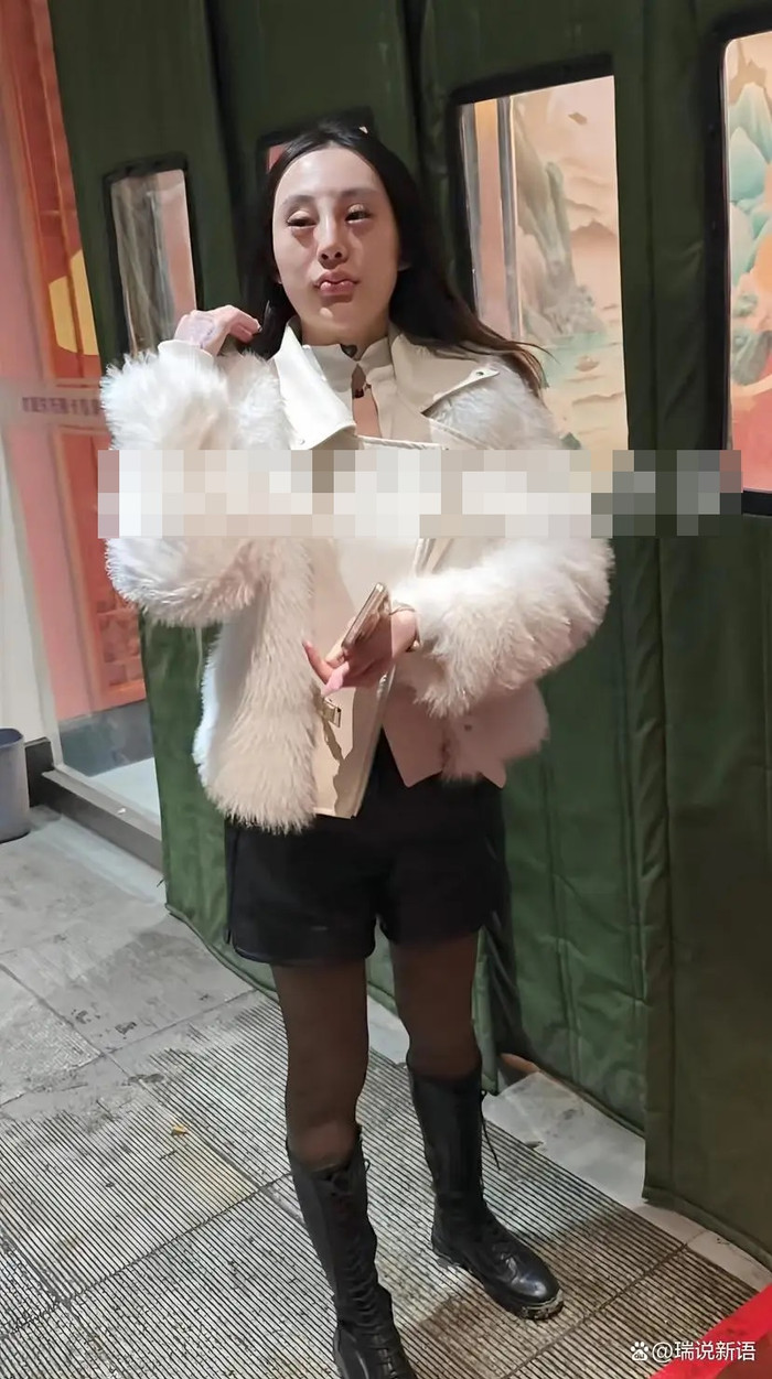 Cô gái 'dao kéo' xong bị bạn trai chia tay, phản ứng bạn thân khi gặp lại gây sốc Ảnh 1