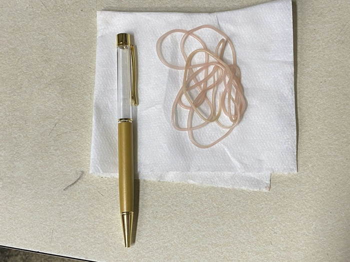 Bút bi chứa ký sinh trùng sống khiến mạng xã hội 'dậy sóng' Ảnh 4