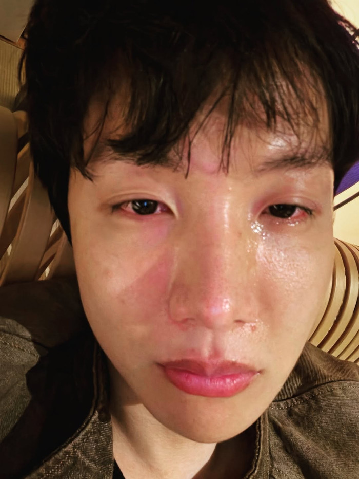 J-Hope (BTS) đăng ảnh nước mắt giàn giụa, gương mặt sưng húp khiến fan xót xa Ảnh 2