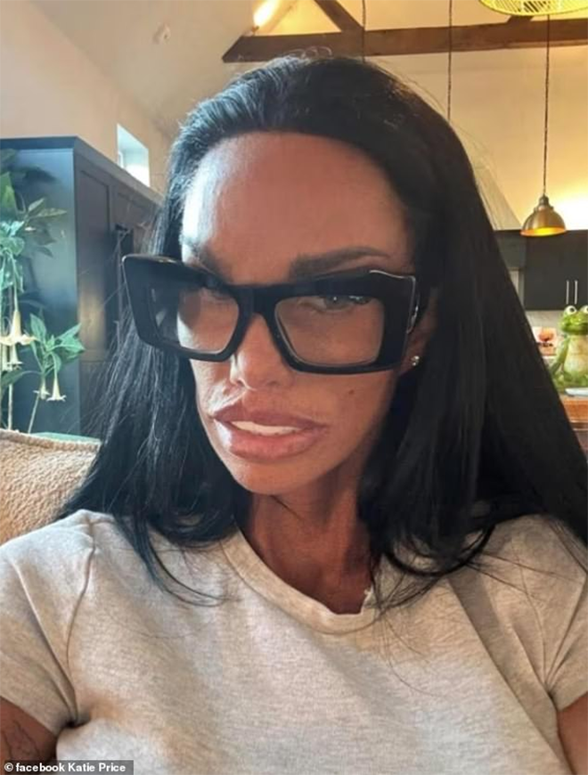 Người mẫu Katie Price chia sẻ bức ảnh khó nhận ra khiến nhiều người hoang mang Ảnh 1