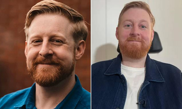 Michael Patrick nổ tiếng với vai diễn trong Game of Thrones. (Ảnh: People)