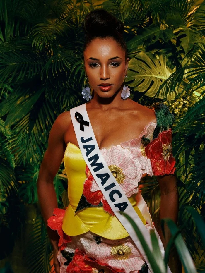 Người đẹp Jamaica xuất hiện lần đầu sau thời gian dài điều trị chấn thương từ cú ngã trên sân khấu Miss Universe.