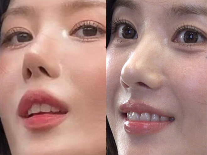 Diện mạo Kwon Eun Bi đang trở thành chủ đề bàn luận trên mạng xã hội.