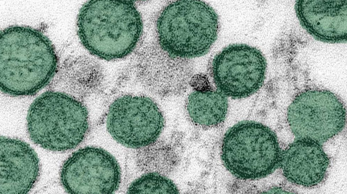 Virus hantavirus được quan sát dưới kính hiển vi. (CDC)