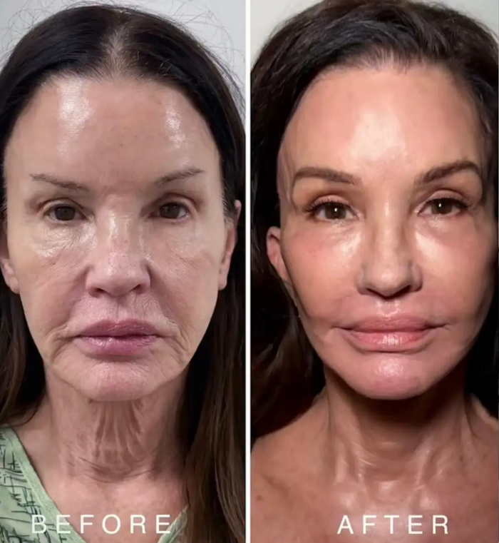 Cựu siêu mẫu Janice Dickinson gây sốt sau cuộc đại phẫu thẩm mỹ, diện mạo tuổi 71 khiến công chúng bất ngờ Ảnh 1