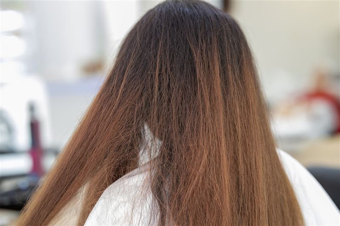Cô gái 19 tuổi nuốt tóc suốt 5 năm đến hói đầu, bác sĩ phát hiện điều kinh hoàng trong dạ dày Ảnh 1