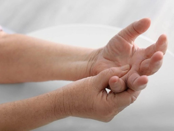 Trời nóng kéo dài, bác sĩ lưu ý 4 dấu hiệu đột quỵ không nên bỏ qua Ảnh 2