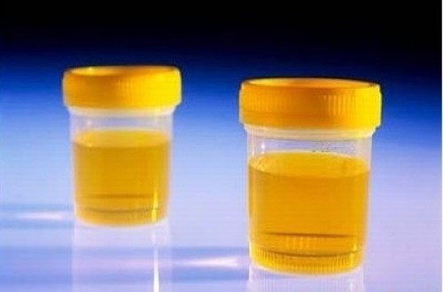 5 dấu hiệu cho thấy cơ thể đang thiếu nước dù bạn không thấy khát Ảnh 1