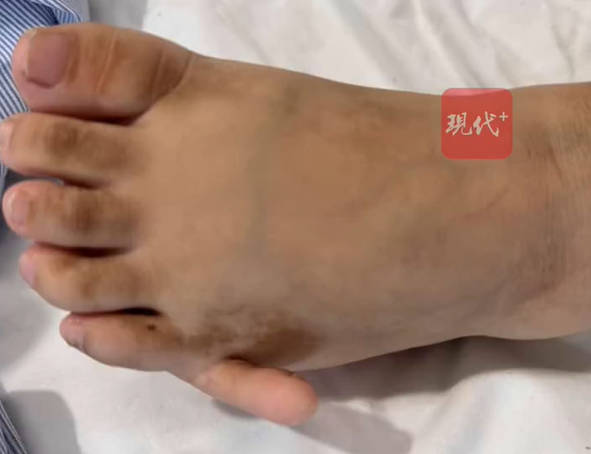 Cô gái có 6 ngón ở cả hai bàn chân, ngoại hình tuổi 17 khiến ai cũng xôn xao Ảnh 2