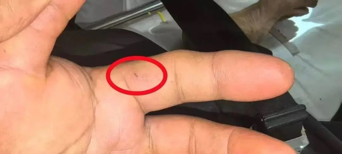 Tưởng rắn không độc nên cầm lên chụp ảnh, người đàn ông phải 'trả giá' đắt Ảnh 2