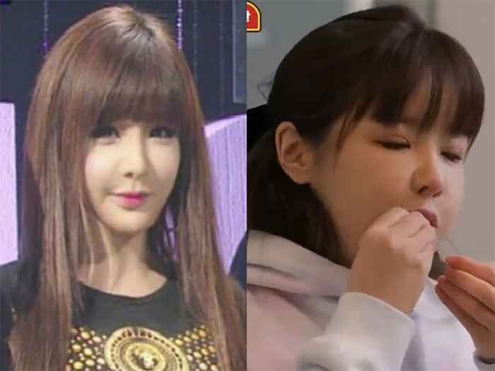 Park Bom từng vướng nghi vấn phẫu thuật thẩm mỹ khi ngoại hình thay đổi đáng kể so với thời còn hoạt động cùng 2NE1.