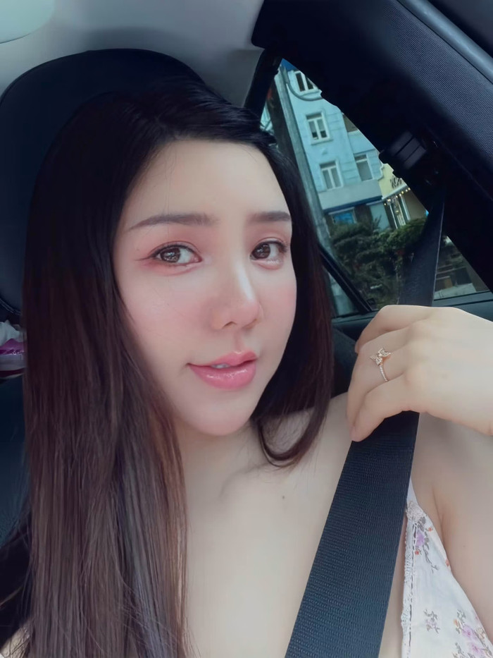 Thực tế, đây không phải lần đầu Quỳnh Kool vướng nghi vấn liên quan đến ngoại hình. (Ảnh: FBNV)