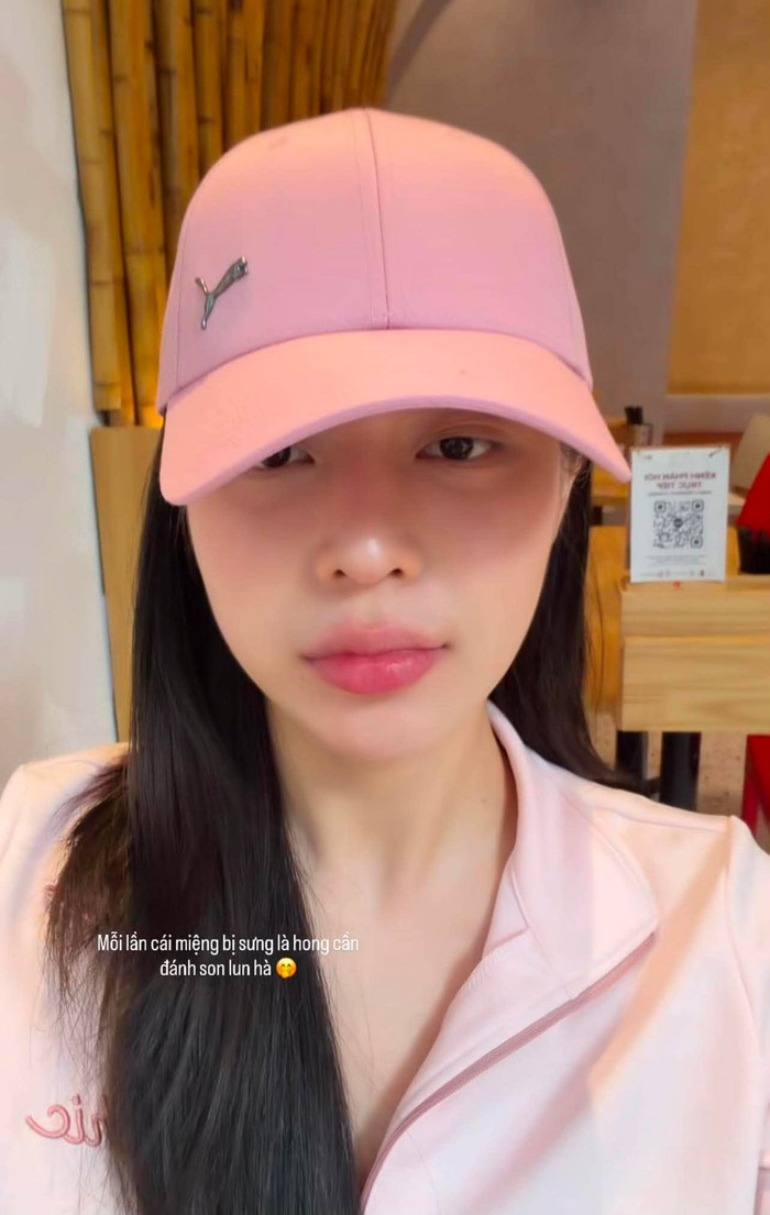 Hoa hậu Thanh Thủy cho biết cô đang bị sưng miệng, môi không thể đánh son.