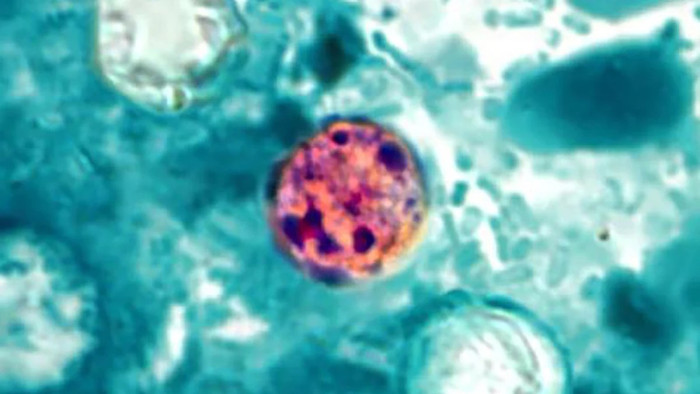 Hình ảnh hiển vi của Cyclospora cayetanensis trong phân. (Ảnh: CDC)&nbsp;