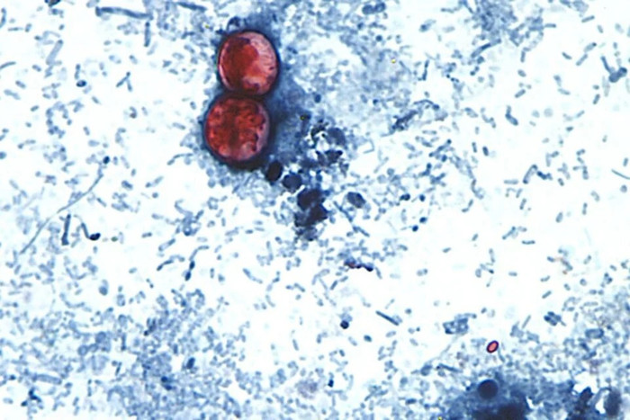 Những người nhiễm Cyclospora cuối cùng sẽ thải ra ngoài phân các dạng ấu trùng của ký sinh trùng gọi là nang trứng (oocyst). Hình ảnh hiển vi ở trên cho thấy một số nang trứng được tìm thấy trong mẫu phân. (Ảnh: CDC)&nbsp;