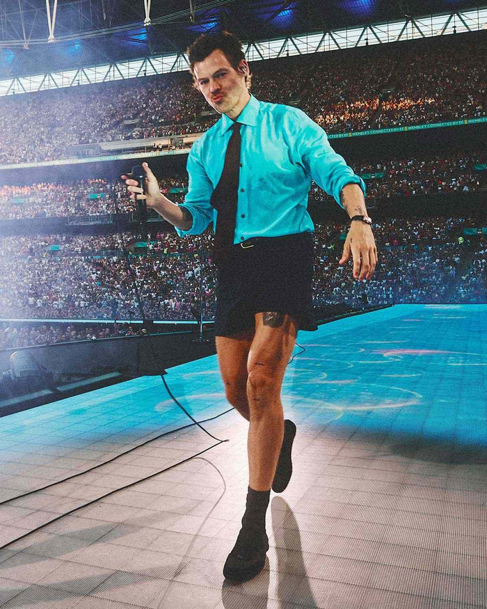 Lo lắng cho Harry Styles Ảnh 6