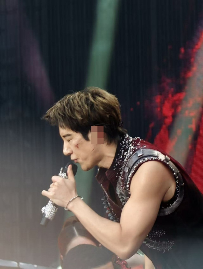 Má trái của Vương Lực Hoành bị bầm tím và dính đầy máu. (Ảnh từ Weibo)