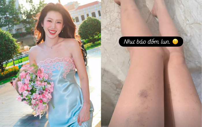 Tình trạng sức khoẻ của Thúy Ngân khiến người hâm mộ không khỏi lo lắng. Ảnh: IGNV