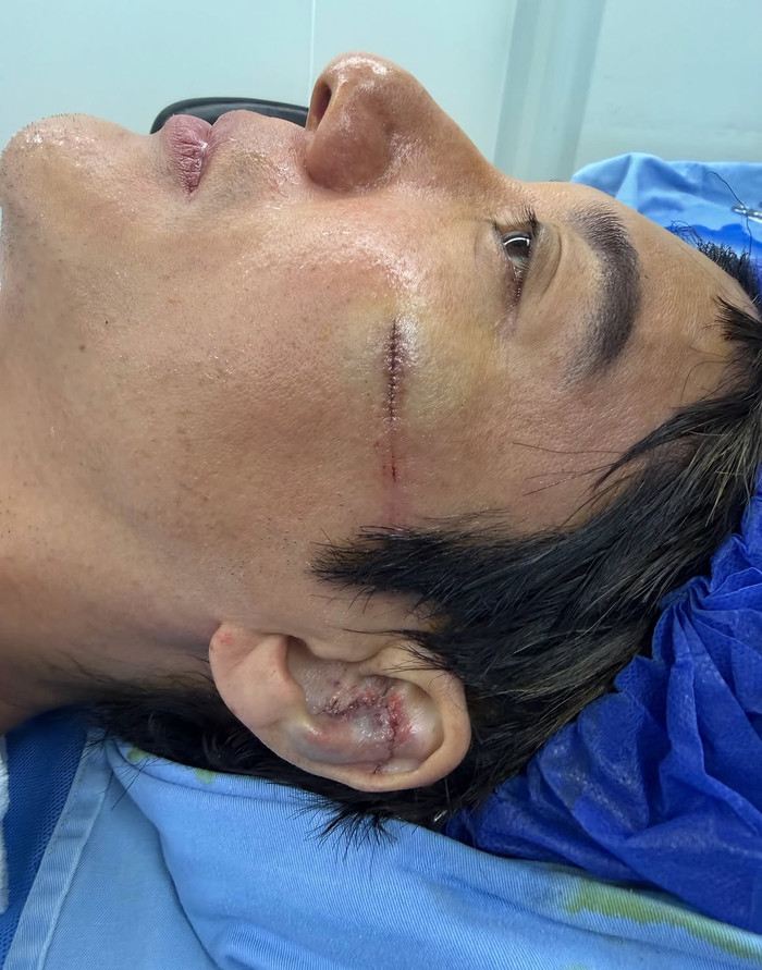Cú ngã trên sân khấu và 'cái giá' không thể đo bằng tiền của Vương Lực Hoành Ảnh 4