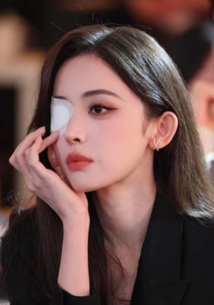 Cổ Lực Na Trát xuất hiện tại sự kiện mang gạc 1 bên mắt khiến người hâm mộ lo lắng. Ảnh: Sina