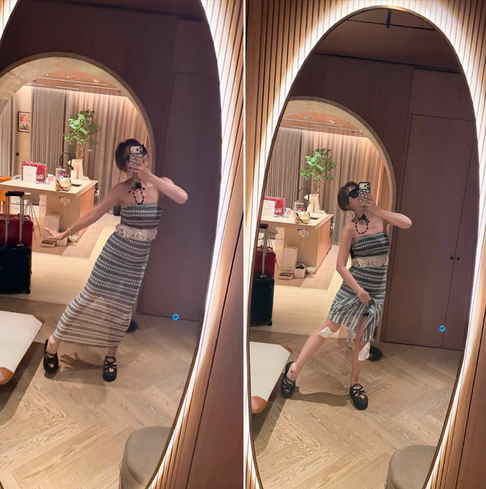 Hari Won chia sẻ việc đầu gối có dấu hiệu bị chấn thương. Ảnh: Chụp màn hình FBNV