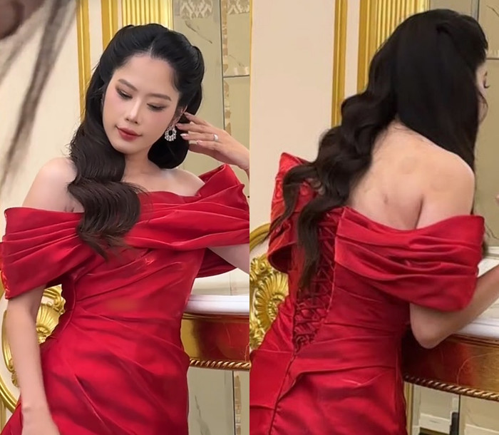 Nam Em để lộ nhiều vết giác hơi trên cơ thể.&nbsp;