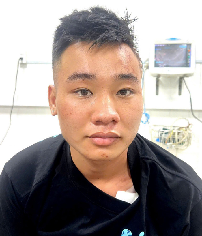 Đối tượng Nguyễn Đức Anh bị nhiều vết thương đang được điều trị tại cơ quan Y tế. Ảnh: Trang Thông tin Chính phủ,&nbsp;