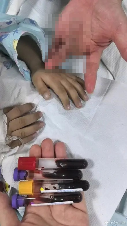 Bé trai 3 tuổi tím tái toàn thân, bác sĩ tìm ra nguyên nhân khiến nhiều phụ huynh giật mình Ảnh 2