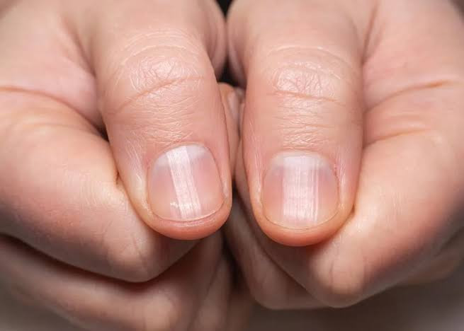 4 thay đổi trên móng tay, tóc và da không nên xem nhẹ Ảnh 1