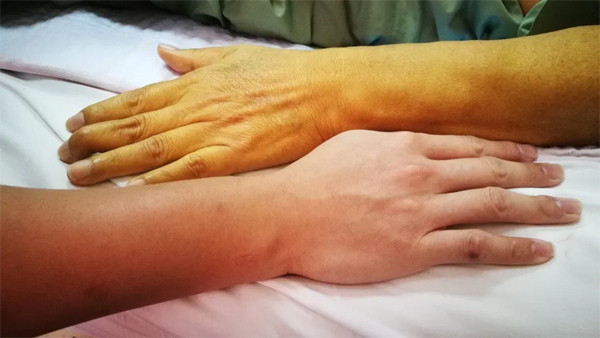 4 thay đổi trên móng tay, tóc và da không nên xem nhẹ Ảnh 3