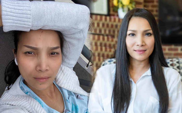 Hồng Ngọc khoe cận cảnh mặt mộc hoàn toàn lành lặn sau khi bị bỏng nặng Ảnh 2