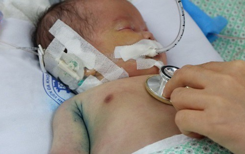 Bé trai bị mẹ bỏ rơi tại hố ga giữa nắng nóng 40 độ C: Máu vẫn nhiễm trùng nặng, thêm tình trạng kháng kháng sinh Ảnh 2