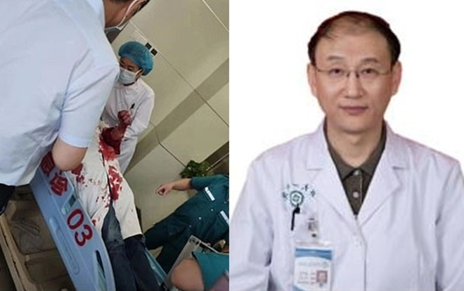 Bác sĩ Meng bị bệnh nhân tấn công tại nơi làm việc.
