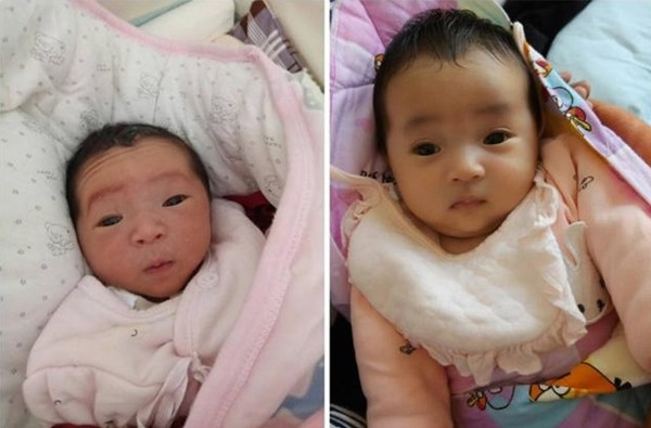 Người mẹ phát khóc khi nhìn con mới sinh tim tím như củ khoai môn, ngoại hình sau 3 tháng mới là điều gây bất ngờ Ảnh 6