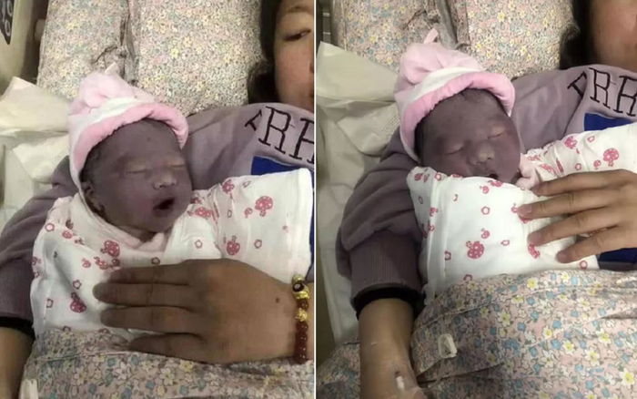 Người mẹ phát khóc khi nhìn con mới sinh tim tím như củ khoai môn, ngoại hình sau 3 tháng mới là điều gây bất ngờ Ảnh 2