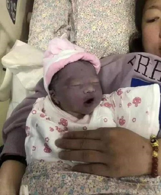 Làn da tím của em bé khiến người mẹ hoang mang, bật khóc